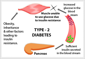 fasting and diabetes